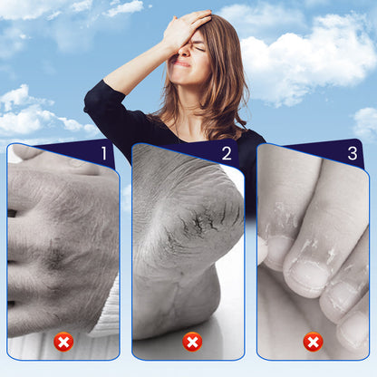 🩹 BUY 2 GET 1 FREE! ✨ Cracked Skin Repair Patch - Deep Hydration for Heels/Elbows, Pain Relief in 2 Hours, Invisible & Waterproof ⏳📦