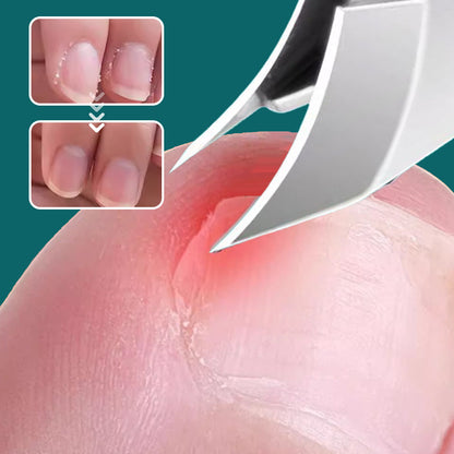 🔥2026 Hot Sale🔥 Anti-Splash 25° Slant Edge Nail Clipper 3-Piece Set